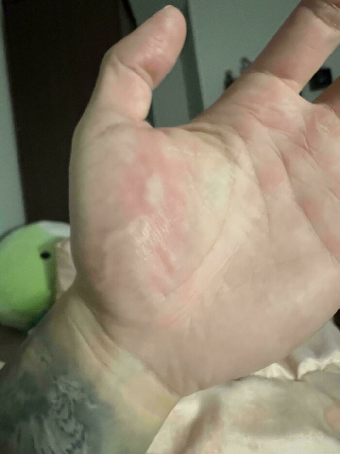 80 Photos Proving The Human Body Is As Strange As It Is Amazing 80 Photos Proving The Human Body Is As Strange As It Is Amazing