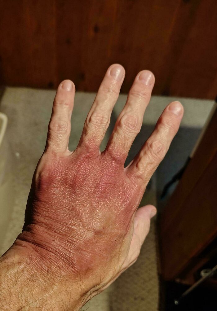 80 Photos Proving The Human Body Is As Strange As It Is Amazing 80 Photos Proving The Human Body Is As Strange As It Is Amazing