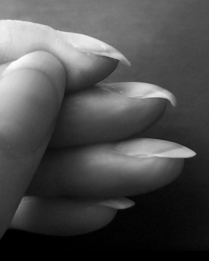 80 Photos Proving The Human Body Is As Strange As It Is Amazing 80 Photos Proving The Human Body Is As Strange As It Is Amazing