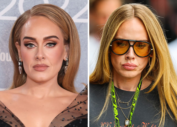 Plastic Surgeon Intervenes After Adele’s Appearance At Rare Public Outing Turns Into Viral Discussion Plastic Surgeon Intervenes After Adele’s Appearance At Rare Public Outing Turns Into Viral Discussion