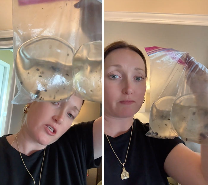 Woman Reveals She Removed Her Painful Breast Implants, And What Was Discovered Inside Left Her Speechless Woman Reveals She Removed Her Painful Breast Implants, And What Was Discovered Inside Left Her Speechless