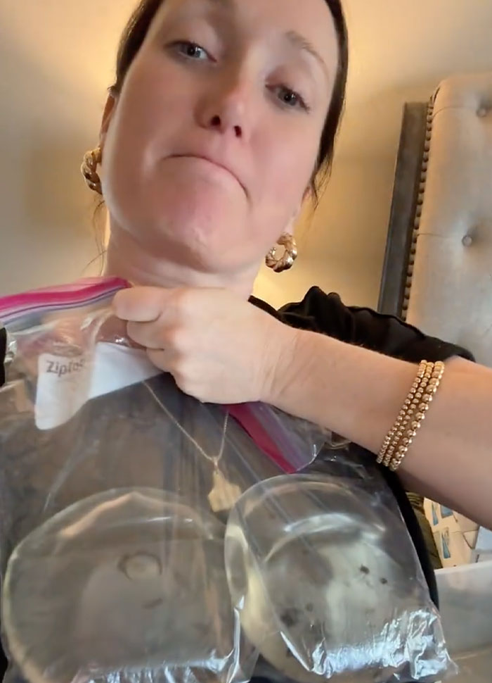 Woman Reveals She Removed Her Painful Breast Implants, And What Was Discovered Inside Left Her Speechless Woman Reveals She Removed Her Painful Breast Implants, And What Was Discovered Inside Left Her Speechless