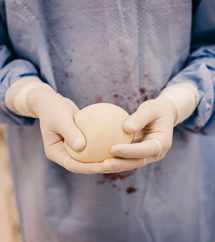 Woman Reveals She Removed Her Painful Breast Implants, And What Was Discovered Inside Left Her Speechless Woman Reveals She Removed Her Painful Breast Implants, And What Was Discovered Inside Left Her Speechless