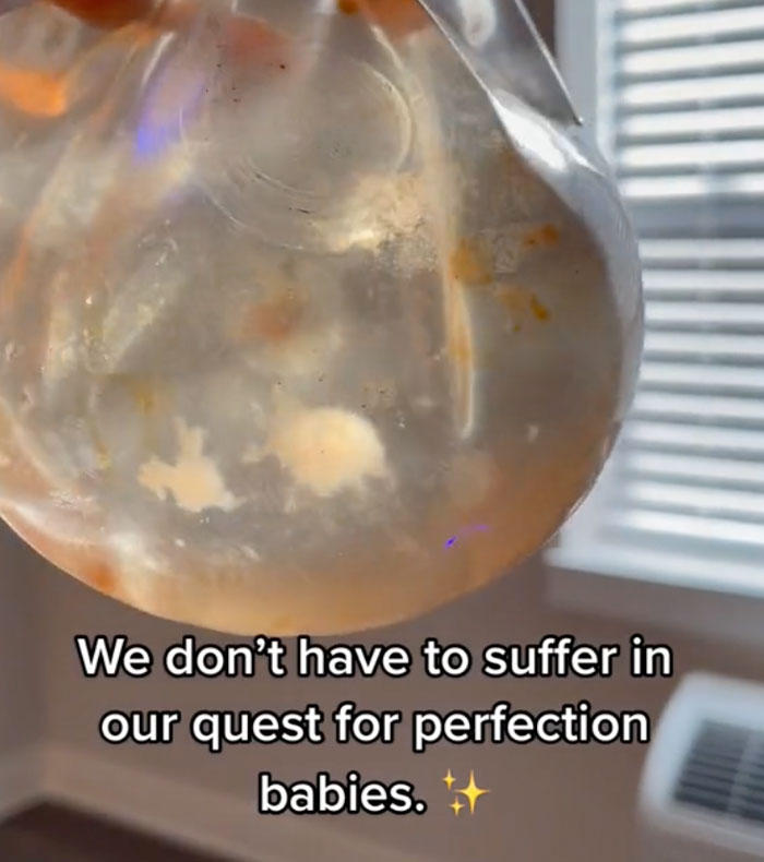 Woman Reveals She Removed Her Painful Breast Implants, And What Was Discovered Inside Left Her Speechless Woman Reveals She Removed Her Painful Breast Implants, And What Was Discovered Inside Left Her Speechless