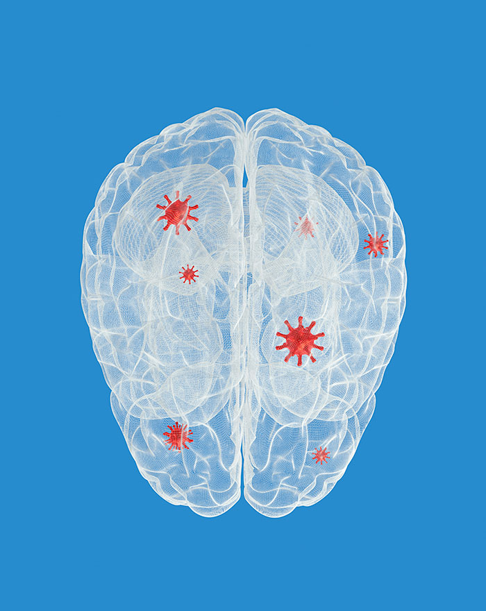 Man’s Suspected Brain Cancer Turns Into A Horror Story As Medical Team Uncovers Something Far Creepier Man’s Suspected Brain Cancer Turns Into A Horror Story As Medical Team Uncovers Something Far Creepier