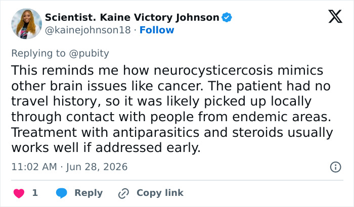 Man’s Suspected Brain Cancer Turns Into A Horror Story As Medical Team Uncovers Something Far Creepier Man’s Suspected Brain Cancer Turns Into A Horror Story As Medical Team Uncovers Something Far Creepier