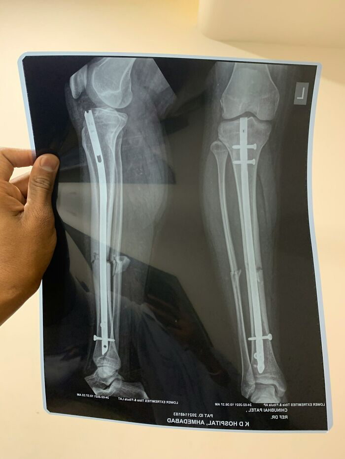 53 Medical Mistakes That Left Even Experienced Doctors Horrified 53 Medical Mistakes That Left Even Experienced Doctors Horrified