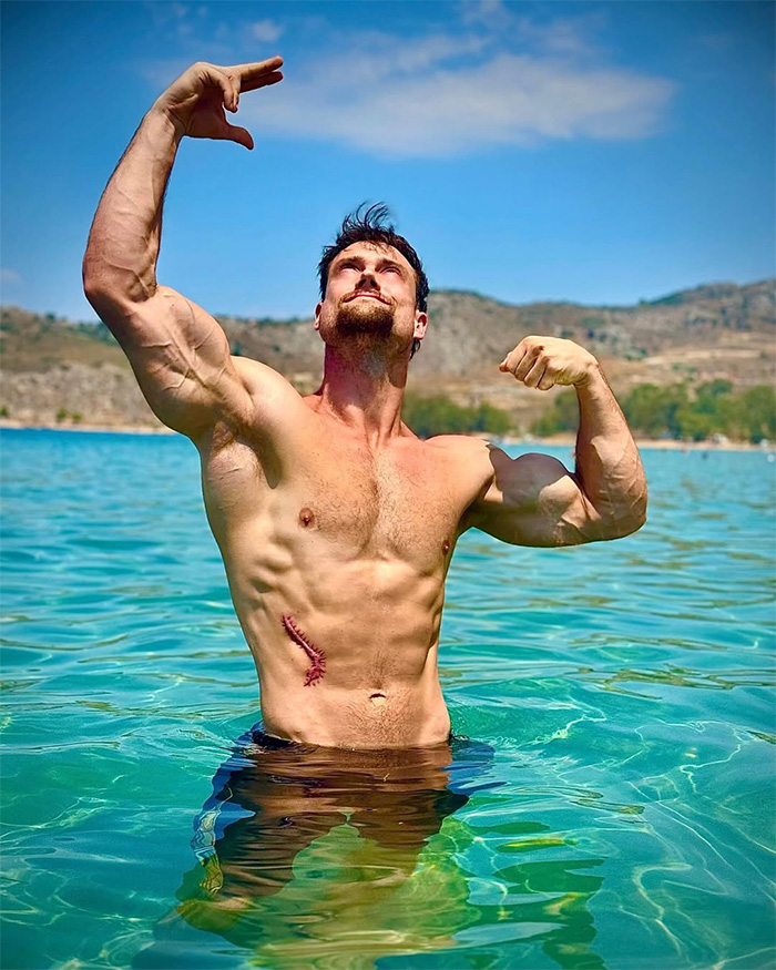 After Lookmaxxer’s Bizarre Passing At 32, His Extreme Transformation Stuns Many After Lookmaxxer’s Bizarre Passing At 32, His Extreme Transformation Stuns Many
