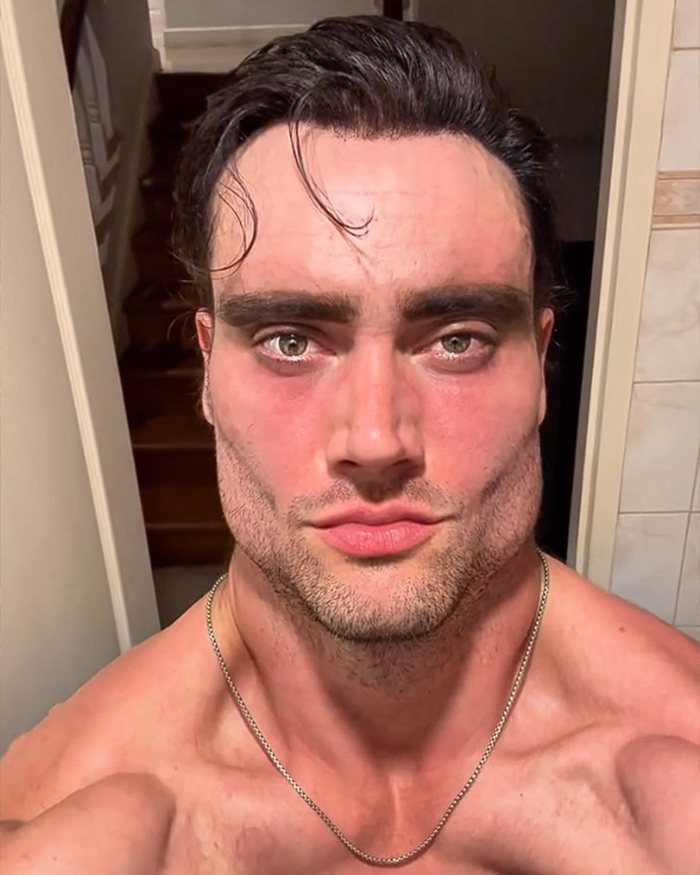 After Lookmaxxer’s Bizarre Passing At 32, His Extreme Transformation Stuns Many After Lookmaxxer’s Bizarre Passing At 32, His Extreme Transformation Stuns Many