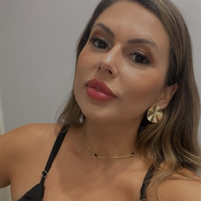 Woman’s Cosmetic Procedure Goes Viral As Her Face Changes Dramatically, Expert Weighs In And Explains The Risks Woman’s Cosmetic Procedure Goes Viral As Her Face Changes Dramatically, Expert Weighs In And Explains The Risks