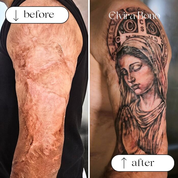 30 Scar Cover-Up Tattoos By Elvira Bono That Help People Feel Comfortable In Their Skin Again 30 Scar Cover-Up Tattoos By Elvira Bono That Help People Feel Comfortable In Their Skin Again