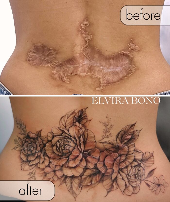 30 Scar Cover-Up Tattoos By Elvira Bono That Help People Feel Comfortable In Their Skin Again 30 Scar Cover-Up Tattoos By Elvira Bono That Help People Feel Comfortable In Their Skin Again