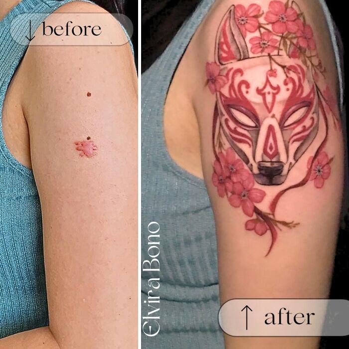 30 Scar Cover-Up Tattoos By Elvira Bono That Help People Feel Comfortable In Their Skin Again 30 Scar Cover-Up Tattoos By Elvira Bono That Help People Feel Comfortable In Their Skin Again