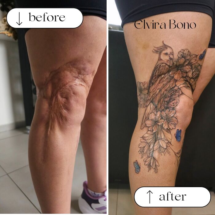 30 Scar Cover-Up Tattoos By Elvira Bono That Help People Feel Comfortable In Their Skin Again 30 Scar Cover-Up Tattoos By Elvira Bono That Help People Feel Comfortable In Their Skin Again