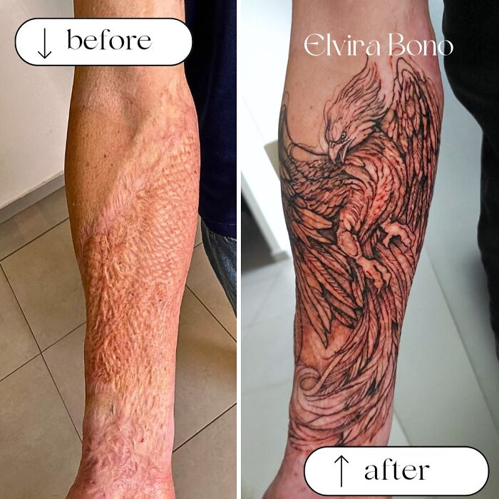 30 Scar Cover-Up Tattoos By Elvira Bono That Help People Feel Comfortable In Their Skin Again 30 Scar Cover-Up Tattoos By Elvira Bono That Help People Feel Comfortable In Their Skin Again