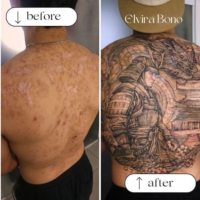 30 Scar Cover-Up Tattoos By Elvira Bono That Help People Feel Comfortable In Their Skin Again 30 Scar Cover-Up Tattoos By Elvira Bono That Help People Feel Comfortable In Their Skin Again