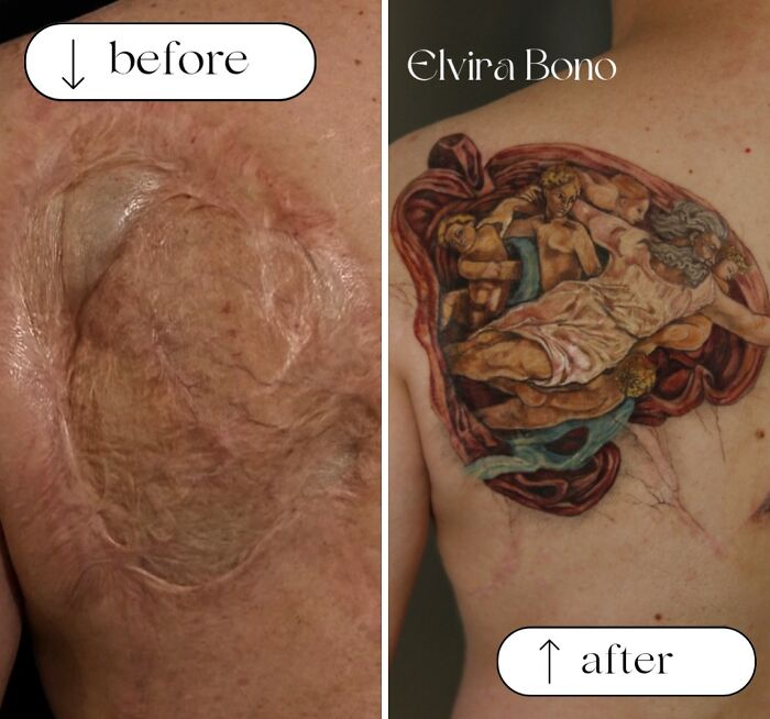 30 Scar Cover-Up Tattoos By Elvira Bono That Help People Feel Comfortable In Their Skin Again 30 Scar Cover-Up Tattoos By Elvira Bono That Help People Feel Comfortable In Their Skin Again