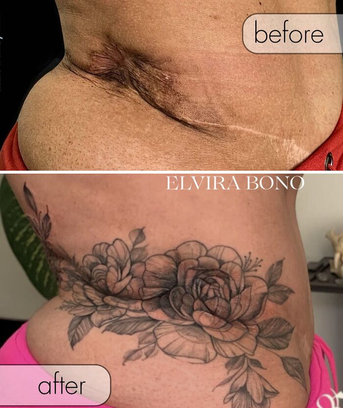 30 Scar Cover-Up Tattoos By Elvira Bono That Help People Feel Comfortable In Their Skin Again 30 Scar Cover-Up Tattoos By Elvira Bono That Help People Feel Comfortable In Their Skin Again