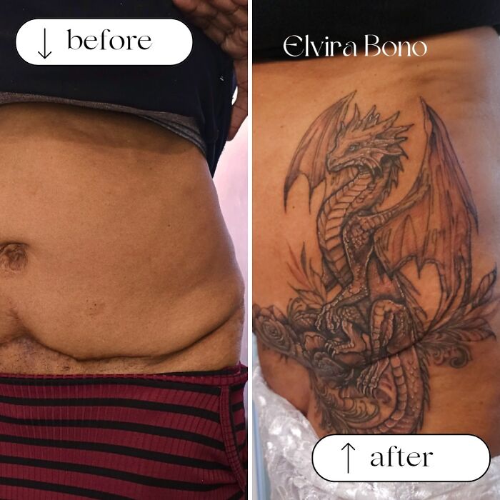 30 Scar Cover-Up Tattoos By Elvira Bono That Help People Feel Comfortable In Their Skin Again 30 Scar Cover-Up Tattoos By Elvira Bono That Help People Feel Comfortable In Their Skin Again