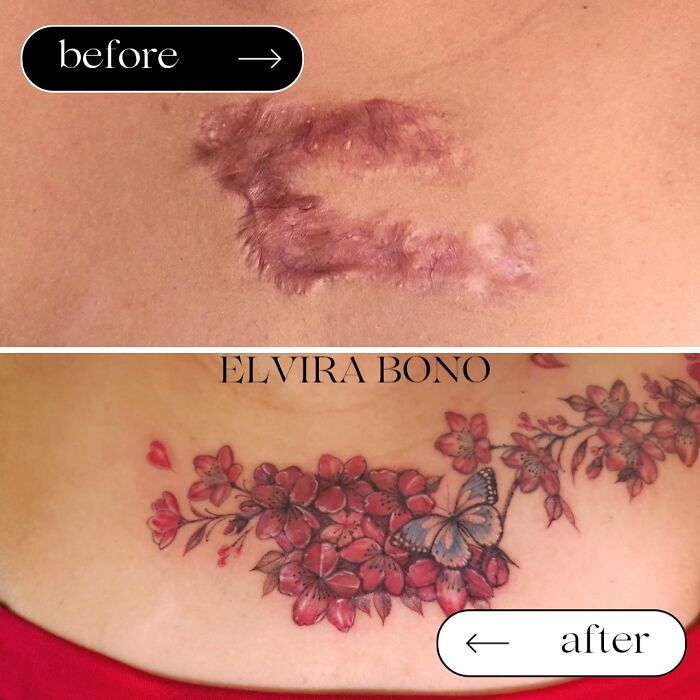 30 Scar Cover-Up Tattoos By Elvira Bono That Help People Feel Comfortable In Their Skin Again 30 Scar Cover-Up Tattoos By Elvira Bono That Help People Feel Comfortable In Their Skin Again