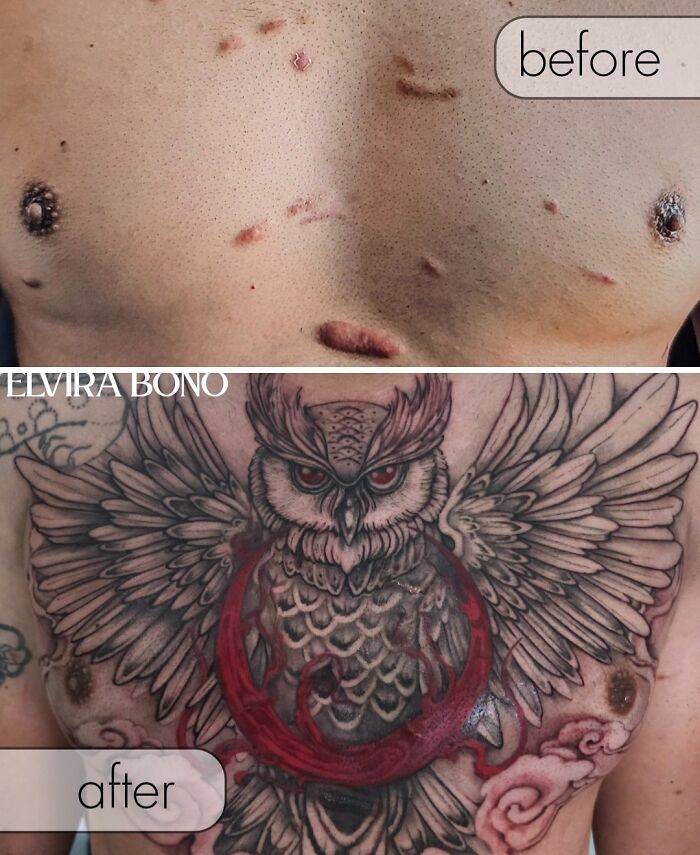 30 Scar Cover-Up Tattoos By Elvira Bono That Help People Feel Comfortable In Their Skin Again 30 Scar Cover-Up Tattoos By Elvira Bono That Help People Feel Comfortable In Their Skin Again