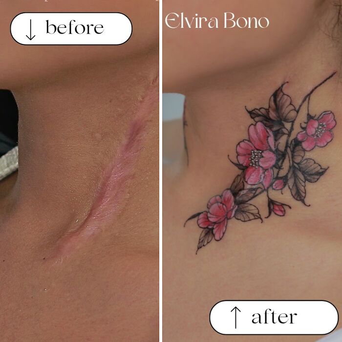 30 Scar Cover-Up Tattoos By Elvira Bono That Help People Feel Comfortable In Their Skin Again 30 Scar Cover-Up Tattoos By Elvira Bono That Help People Feel Comfortable In Their Skin Again