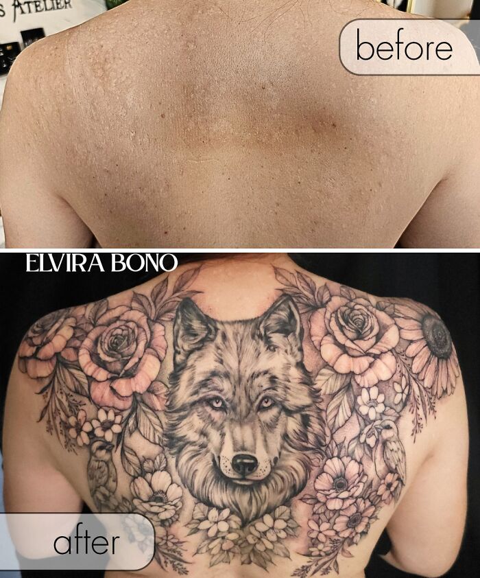 30 Scar Cover-Up Tattoos By Elvira Bono That Help People Feel Comfortable In Their Skin Again 30 Scar Cover-Up Tattoos By Elvira Bono That Help People Feel Comfortable In Their Skin Again