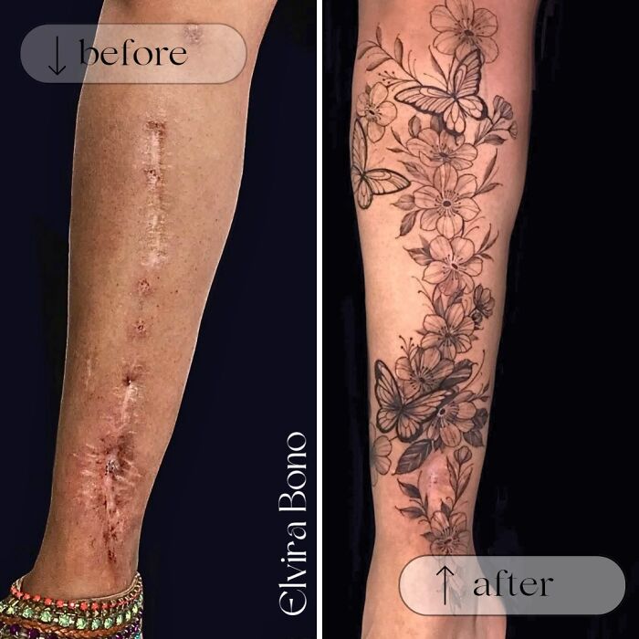 30 Scar Cover-Up Tattoos By Elvira Bono That Help People Feel Comfortable In Their Skin Again 30 Scar Cover-Up Tattoos By Elvira Bono That Help People Feel Comfortable In Their Skin Again