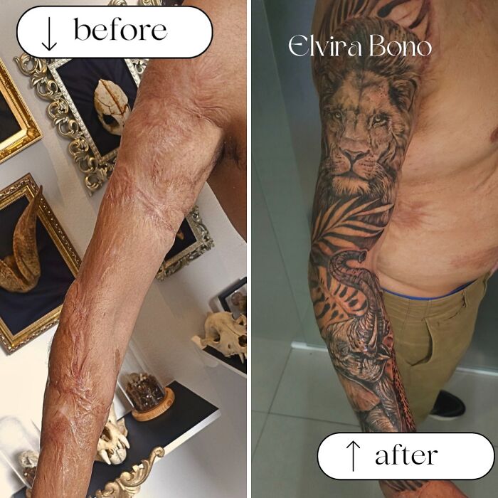 30 Scar Cover-Up Tattoos By Elvira Bono That Help People Feel Comfortable In Their Skin Again 30 Scar Cover-Up Tattoos By Elvira Bono That Help People Feel Comfortable In Their Skin Again