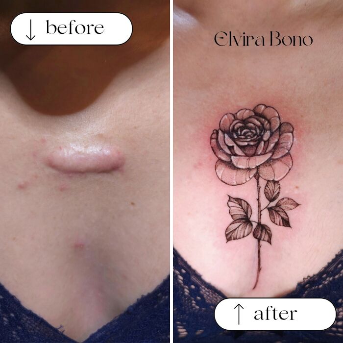 30 Scar Cover-Up Tattoos By Elvira Bono That Help People Feel Comfortable In Their Skin Again 30 Scar Cover-Up Tattoos By Elvira Bono That Help People Feel Comfortable In Their Skin Again