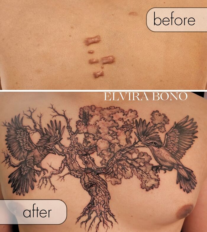 30 Scar Cover-Up Tattoos By Elvira Bono That Help People Feel Comfortable In Their Skin Again 30 Scar Cover-Up Tattoos By Elvira Bono That Help People Feel Comfortable In Their Skin Again