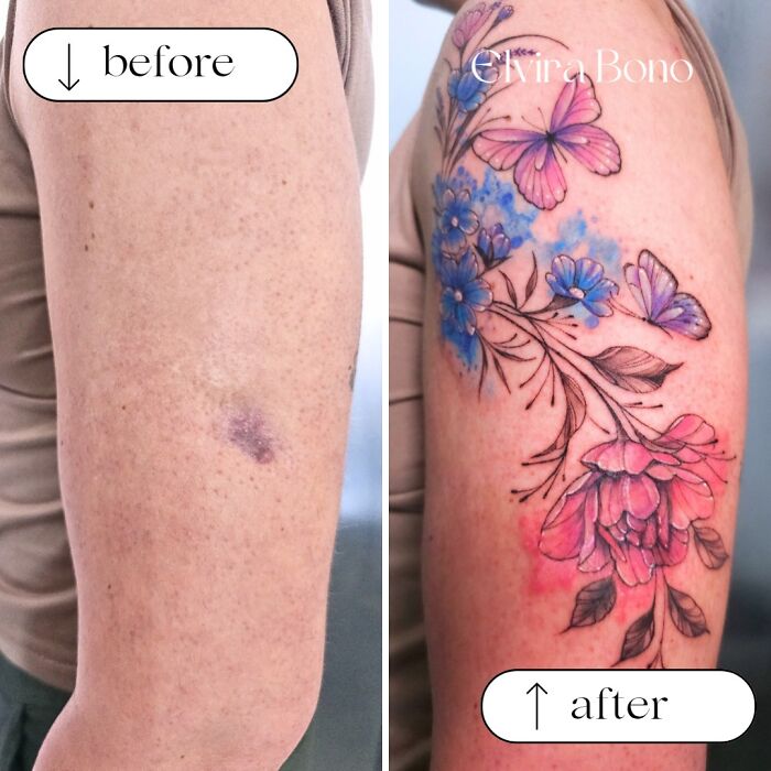 30 Scar Cover-Up Tattoos By Elvira Bono That Help People Feel Comfortable In Their Skin Again 30 Scar Cover-Up Tattoos By Elvira Bono That Help People Feel Comfortable In Their Skin Again