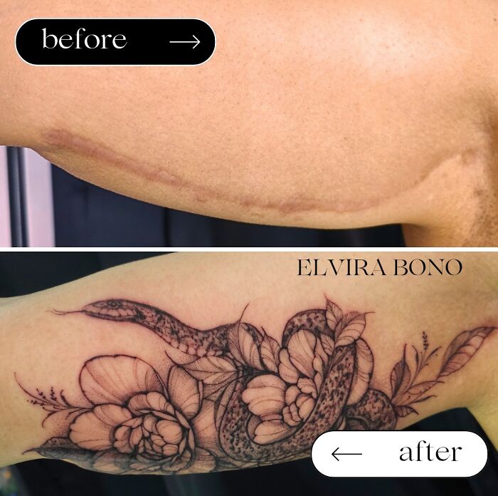 30 Scar Cover-Up Tattoos By Elvira Bono That Help People Feel Comfortable In Their Skin Again 30 Scar Cover-Up Tattoos By Elvira Bono That Help People Feel Comfortable In Their Skin Again