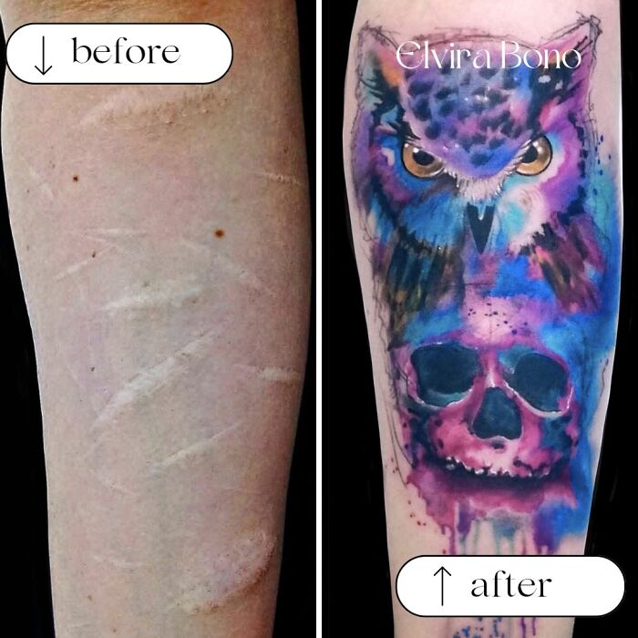 30 Scar Cover-Up Tattoos By Elvira Bono That Help People Feel Comfortable In Their Skin Again 30 Scar Cover-Up Tattoos By Elvira Bono That Help People Feel Comfortable In Their Skin Again