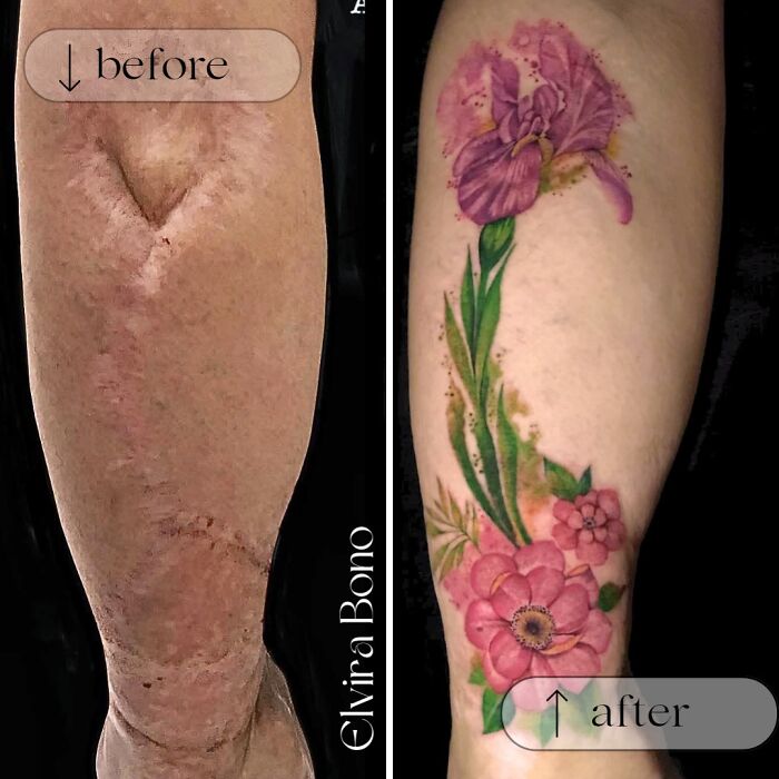 30 Scar Cover-Up Tattoos By Elvira Bono That Help People Feel Comfortable In Their Skin Again 30 Scar Cover-Up Tattoos By Elvira Bono That Help People Feel Comfortable In Their Skin Again