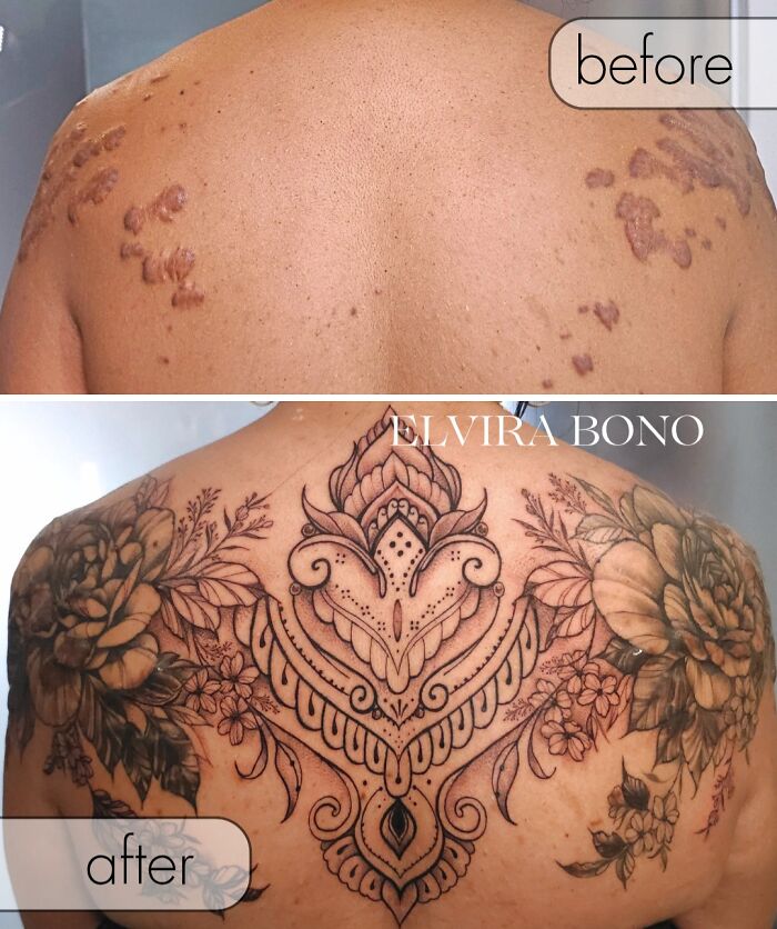 30 Scar Cover-Up Tattoos By Elvira Bono That Help People Feel Comfortable In Their Skin Again 30 Scar Cover-Up Tattoos By Elvira Bono That Help People Feel Comfortable In Their Skin Again