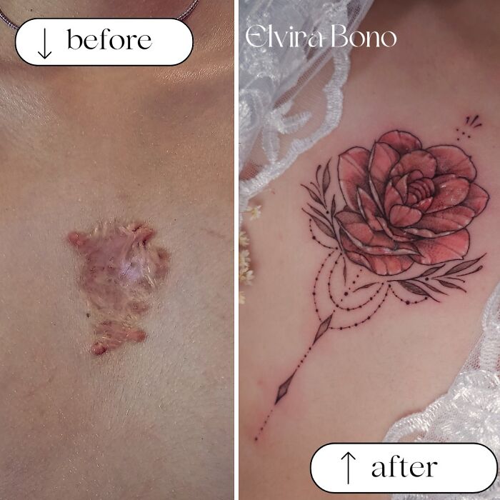 30 Scar Cover-Up Tattoos By Elvira Bono That Help People Feel Comfortable In Their Skin Again 30 Scar Cover-Up Tattoos By Elvira Bono That Help People Feel Comfortable In Their Skin Again