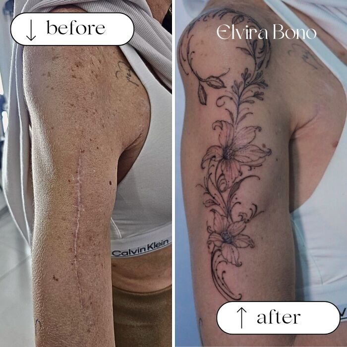 30 Scar Cover-Up Tattoos By Elvira Bono That Help People Feel Comfortable In Their Skin Again 30 Scar Cover-Up Tattoos By Elvira Bono That Help People Feel Comfortable In Their Skin Again
