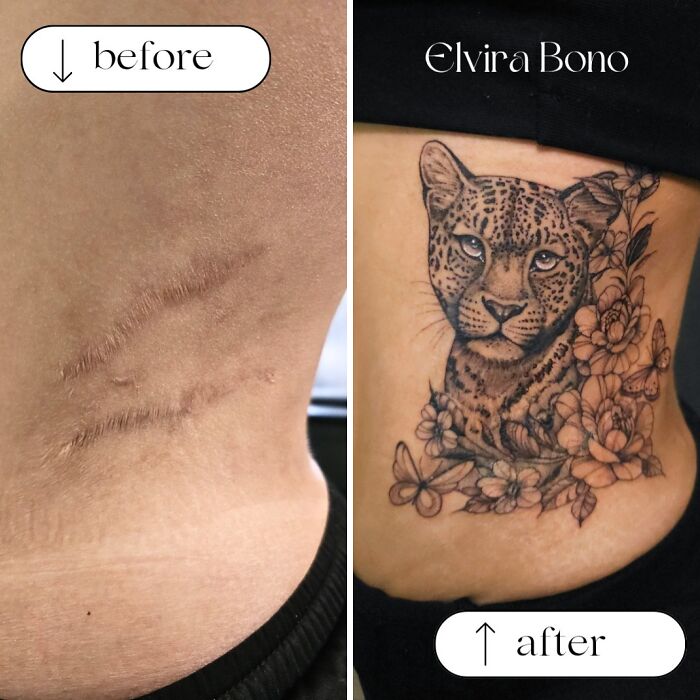 30 Scar Cover-Up Tattoos By Elvira Bono That Help People Feel Comfortable In Their Skin Again 30 Scar Cover-Up Tattoos By Elvira Bono That Help People Feel Comfortable In Their Skin Again