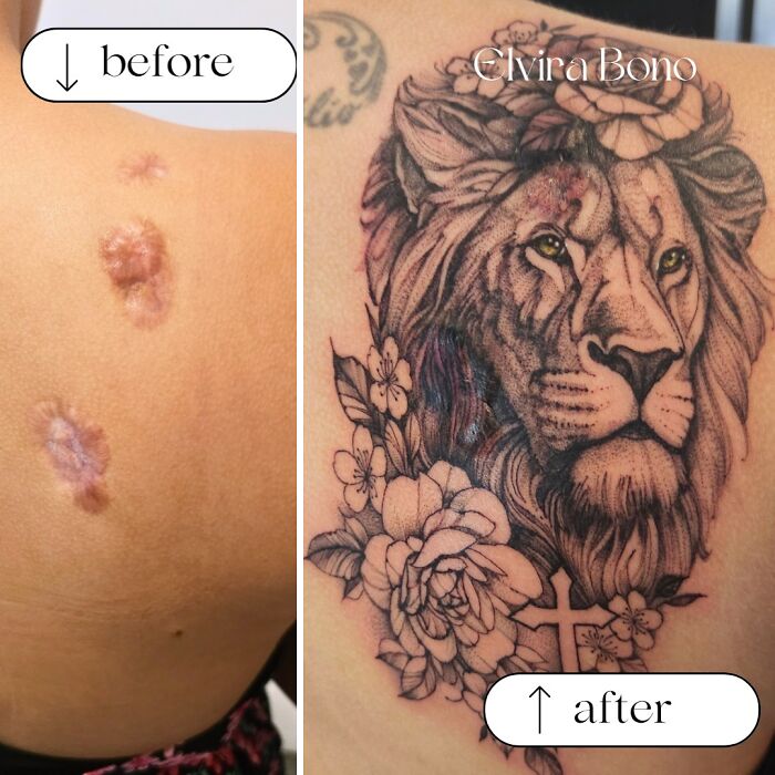 30 Scar Cover-Up Tattoos By Elvira Bono That Help People Feel Comfortable In Their Skin Again 30 Scar Cover-Up Tattoos By Elvira Bono That Help People Feel Comfortable In Their Skin Again