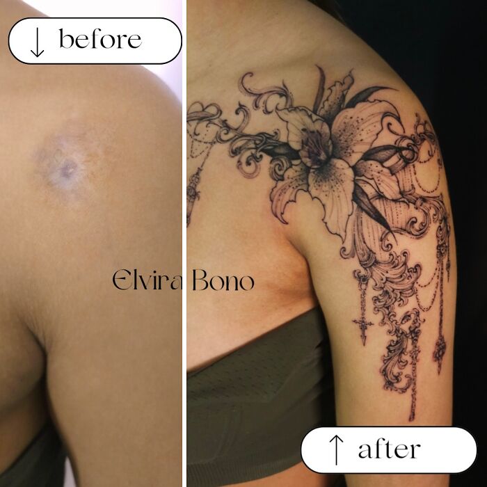 30 Scar Cover-Up Tattoos By Elvira Bono That Help People Feel Comfortable In Their Skin Again 30 Scar Cover-Up Tattoos By Elvira Bono That Help People Feel Comfortable In Their Skin Again