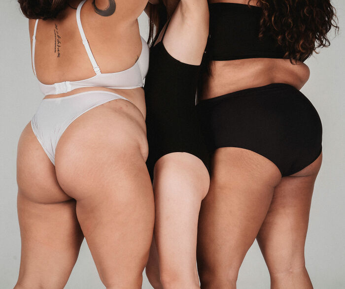 Doctor Intervenes After Woman’s “Reminder” About What Real Bodies Look Like Triggers Health Debate Doctor Intervenes After Woman’s “Reminder” About What Real Bodies Look Like Triggers Health Debate