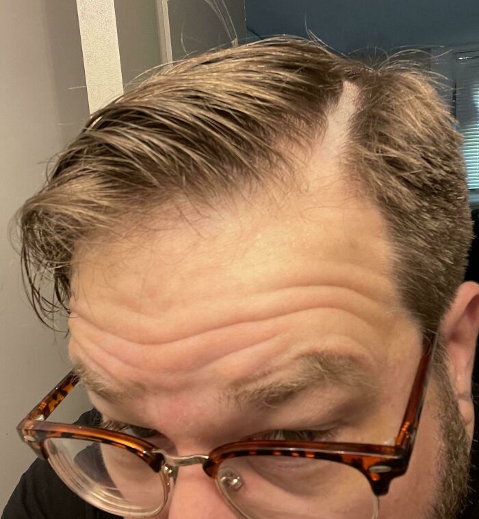 Some Hairdressers Should Have Their Licenses Revoked, And These 56 Haircuts Prove That Some Hairdressers Should Have Their Licenses Revoked, And These 56 Haircuts Prove That