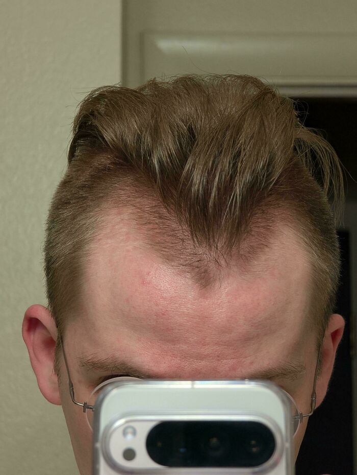 Some Hairdressers Should Have Their Licenses Revoked, And These 56 Haircuts Prove That Some Hairdressers Should Have Their Licenses Revoked, And These 56 Haircuts Prove That