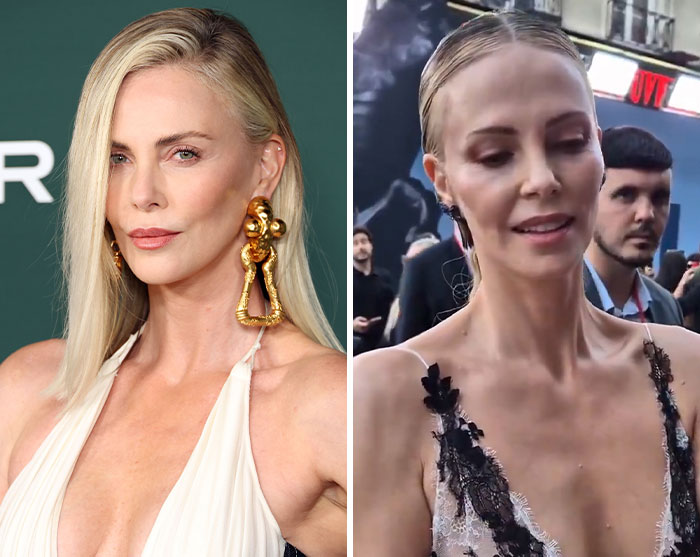 Ever Thinner Celebrities Trend In Hollywood Grows As Charlize Theron Is The Latest To Trigger Worry From Fans Ever Thinner Celebrities Trend In Hollywood Grows As Charlize Theron Is The Latest To Trigger Worry From Fans