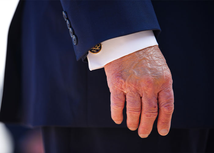 Trump “Struggles” To Power Through Public Appearance, Then A New Health Concern Steals The Spotlight Trump “Struggles” To Power Through Public Appearance, Then A New Health Concern Steals The Spotlight