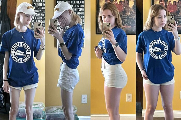 90 Amazing Before And After Photos Of People Changing Into Who They Want To Be 90 Amazing Before And After Photos Of People Changing Into Who They Want To Be