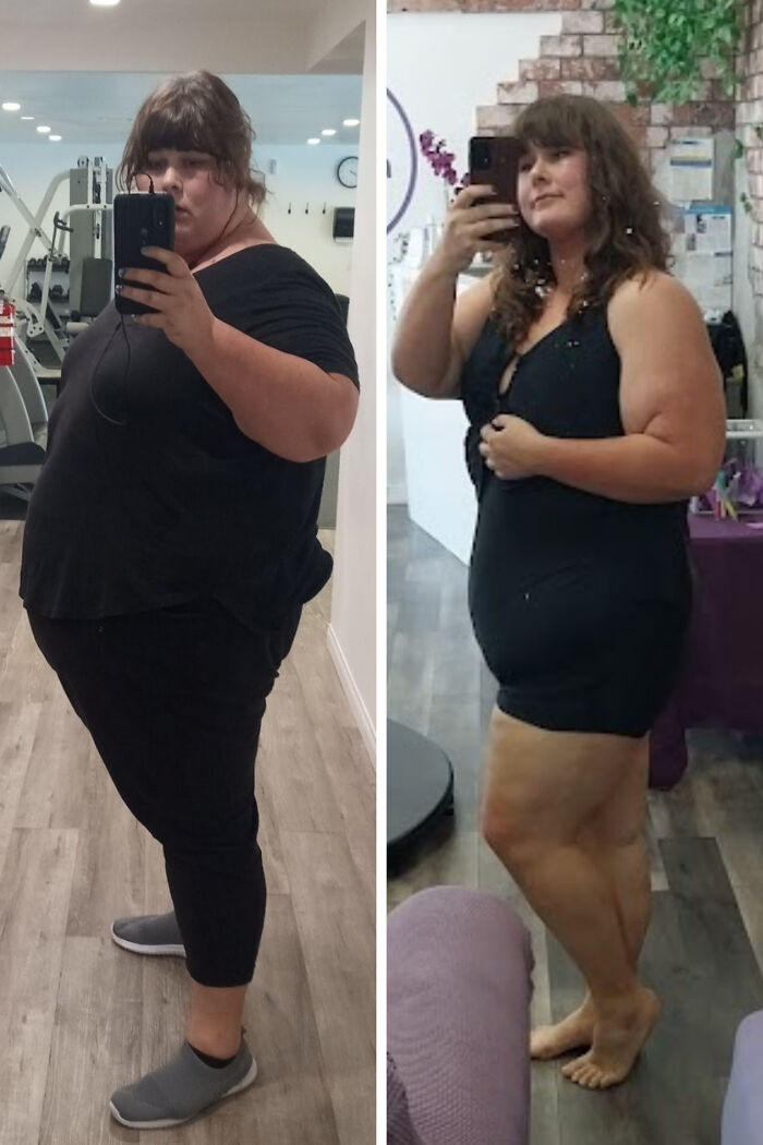 90 Amazing Before And After Photos Of People Changing Into Who They Want To Be 90 Amazing Before And After Photos Of People Changing Into Who They Want To Be