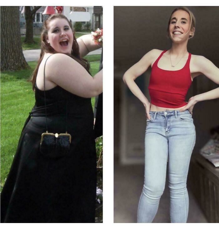 90 Amazing Before And After Photos Of People Changing Into Who They Want To Be 90 Amazing Before And After Photos Of People Changing Into Who They Want To Be