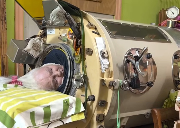 Woman, 78, Last Polio Survivor Living In Iron Lung, Passes Away After Machine Becomes Too Old To Repair